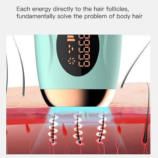 IPL Otthoni Szőrtelenítő - Türkizzöld/Bronz, 999 999 villanás, 5 fokozat - BShopyX001LGREEN001_1